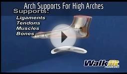 Arch Supports For High Arches